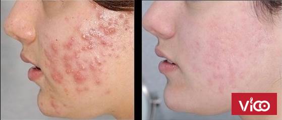 Làm Đẹp hiệu quả