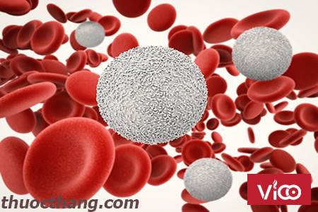 Tại sao mắc phải bệnh bạch cầu Lympho mạn tính