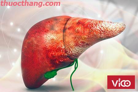 Bệnh men gan cao và những điều cần biết.